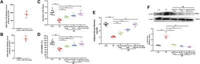 Potential regulatory role of miRNA and mRNA link to metabolism affected by chronic intermittent hypoxia